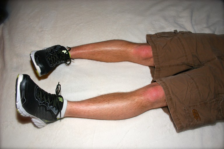 Total Hip Replacement Rehab Tips From A Physical Therapist